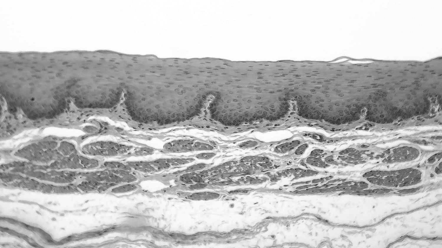 Buzzword alert? Skin Barrier
